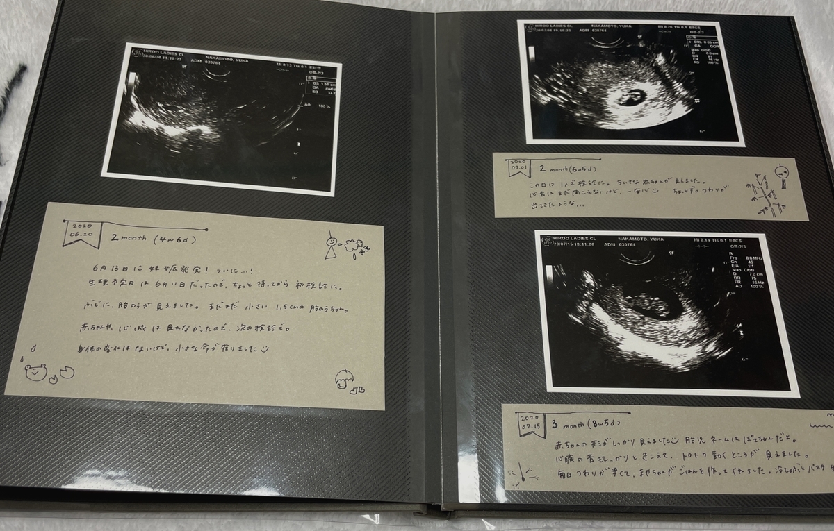 大反省のエコー写真アルバム作り Oimofam S Blog