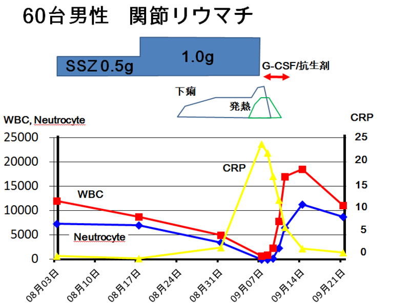無顆粒球症の治療選択肢