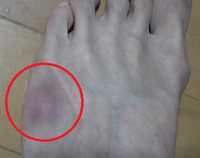 f:id:oiyan-run:20171223080638j:plain f:id:oiyan-run:20171223080638j:plain