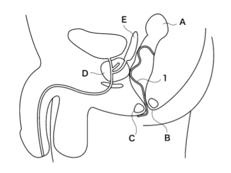 出願後に公開されたお尻チップの図面