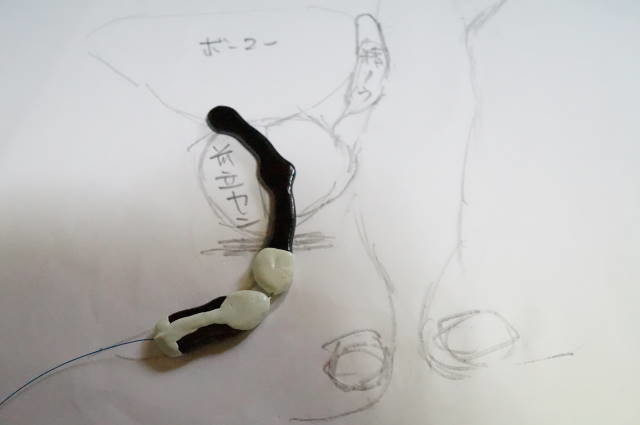 角度調節ができるロングチップ・覚醒の標準留置例