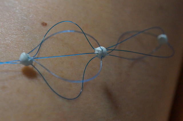 ロゴへの応答として糸で前立腺の輪郭を表した作品