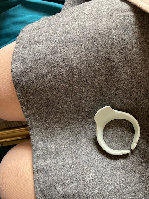 留置用リングを作った近況に添えられた器具の写真