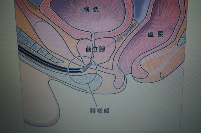 直腸からの振動が前立腺に到達する仕組み