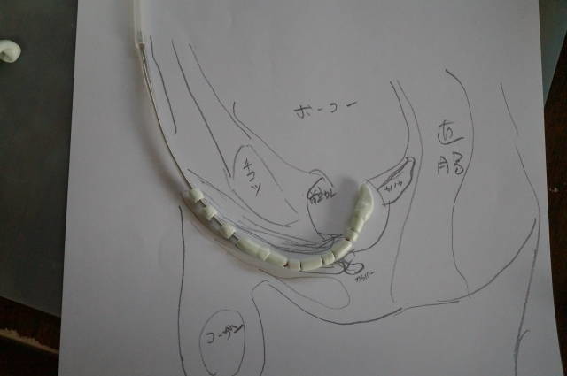 先端が浮遊4線でできたブジー