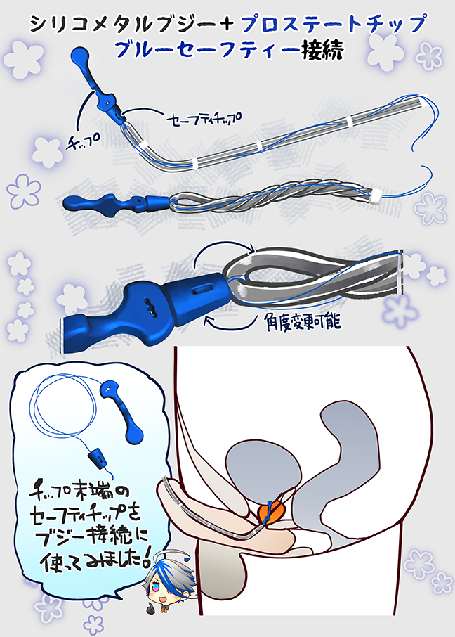 シリコメタルブジーとチップの接続のイラスト