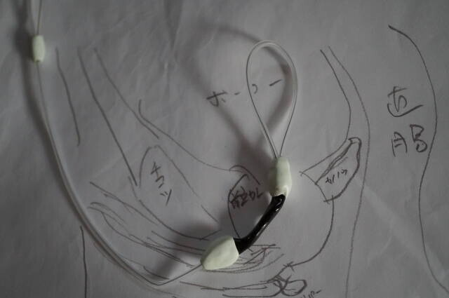 A revised wire bend discussed for improved positioning in November 2024.