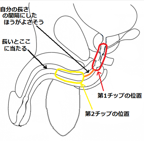 最適な電極（チップ）の位置に関する考察図