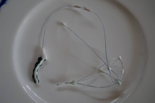 相談後に制作された補強付き陶器チップの完成例