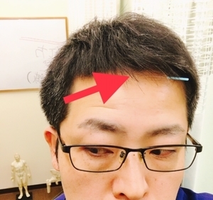f:id:okadahariseikotsu81:20190312201016j:plain f:id:okadahariseikotsu81:20190312201016j:plain