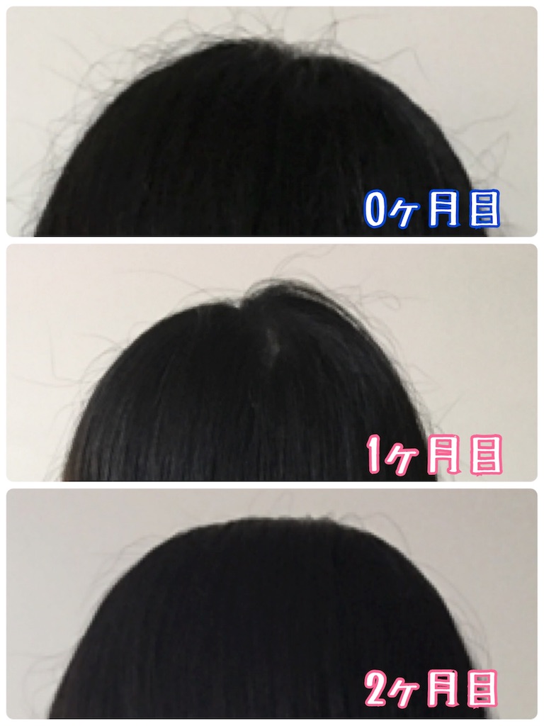 f:id:oki-gura:20181110113543j:image f:id:oki-gura:20181110113543j:image