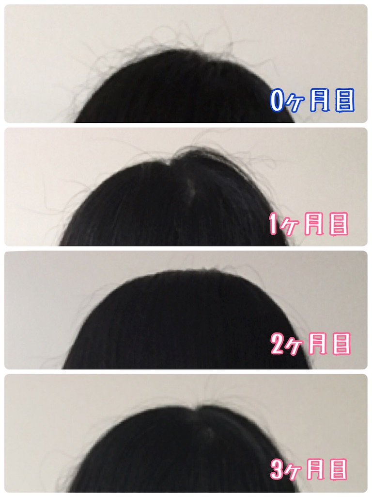 f:id:oki-gura:20181210223517j:image f:id:oki-gura:20181210223517j:image