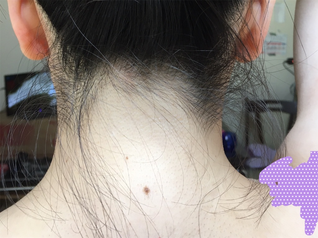 f:id:oki-gura:20190222223619j:plain f:id:oki-gura:20190222223619j:plain