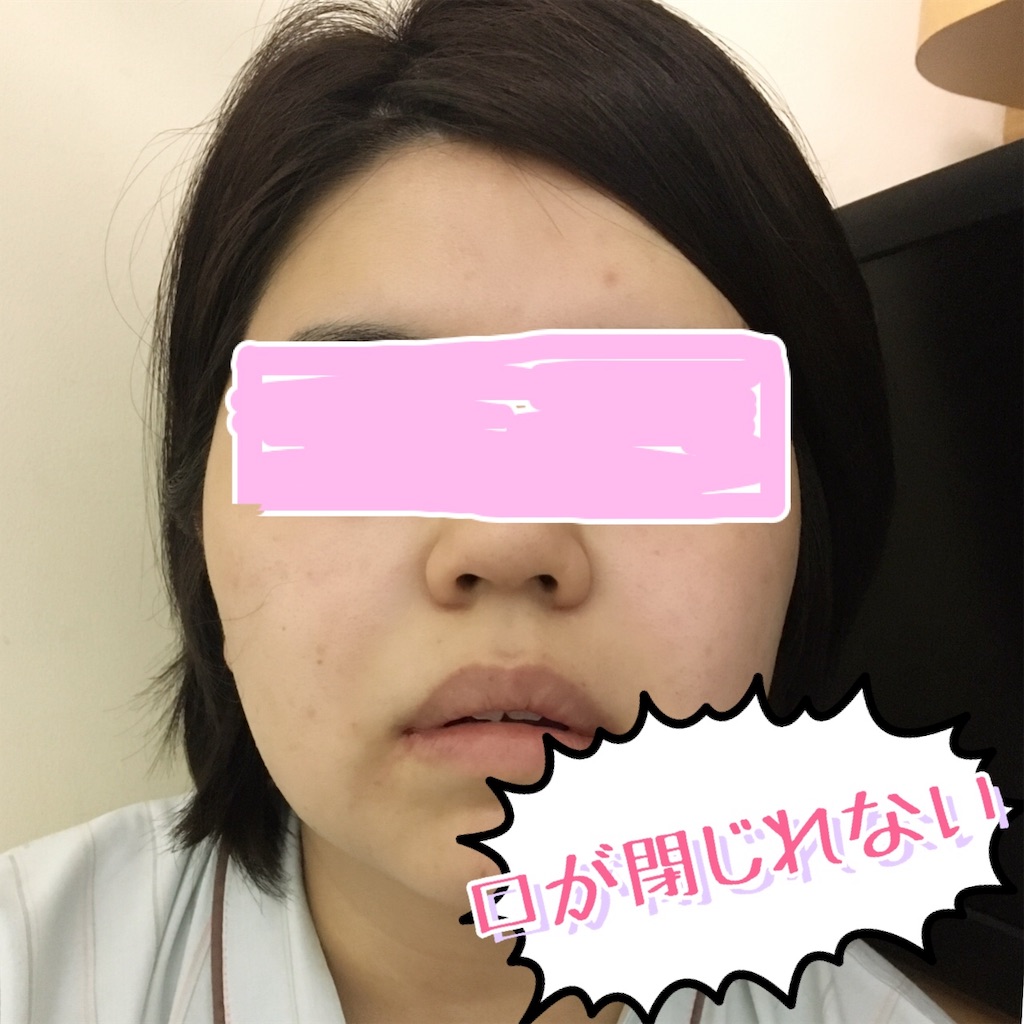f:id:oki-gura:20190505233037j:plain f:id:oki-gura:20190505233037j:plain