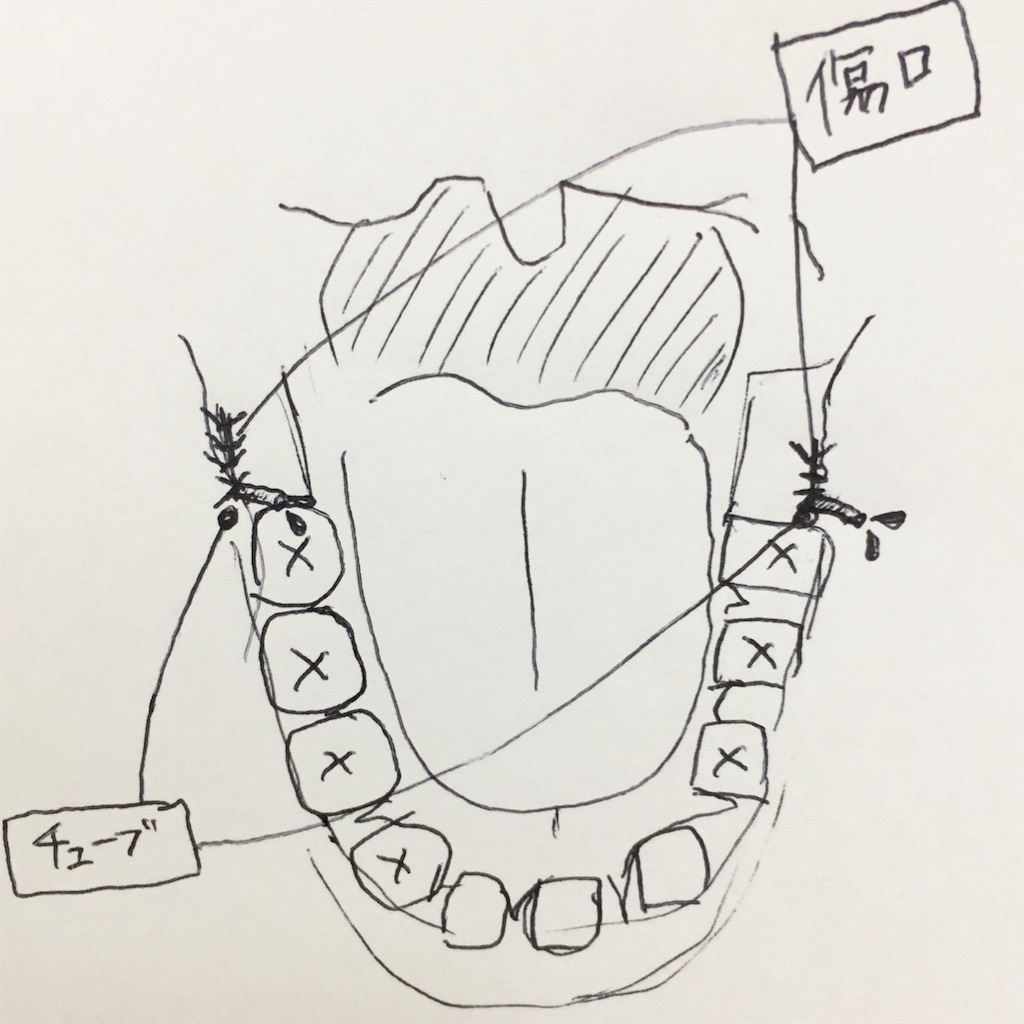 f:id:oki-gura:20190506141732j:image f:id:oki-gura:20190506141732j:image