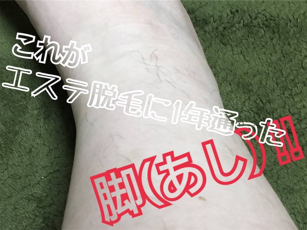 f:id:oki-gura:20190716131828j:image f:id:oki-gura:20190716131828j:image