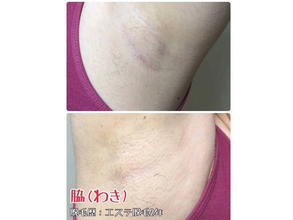 f:id:oki-gura:20190716131832j:image f:id:oki-gura:20190716131832j:image