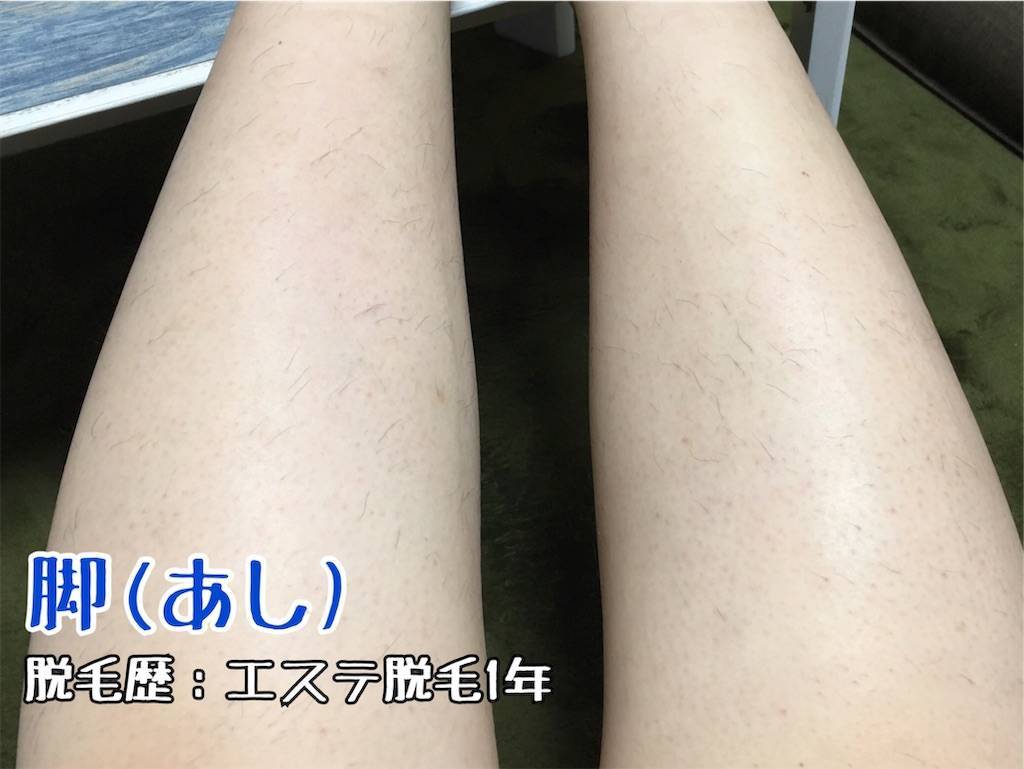 f:id:oki-gura:20190716131835j:image f:id:oki-gura:20190716131835j:image