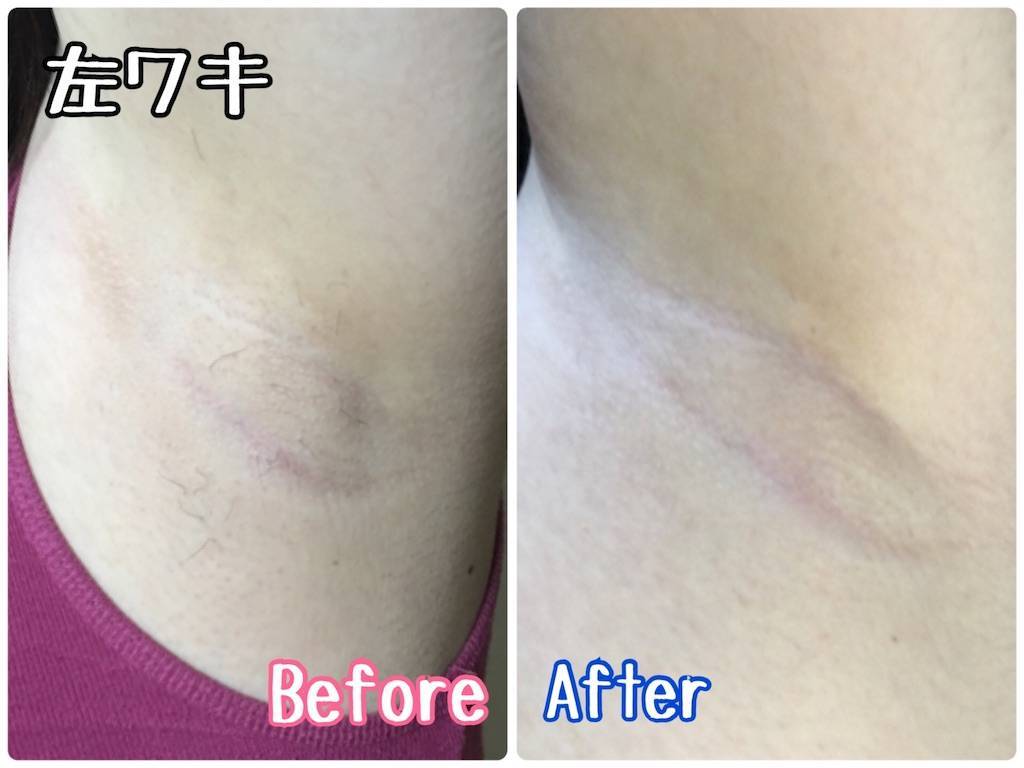 f:id:oki-gura:20190803225641j:image f:id:oki-gura:20190803225641j:image