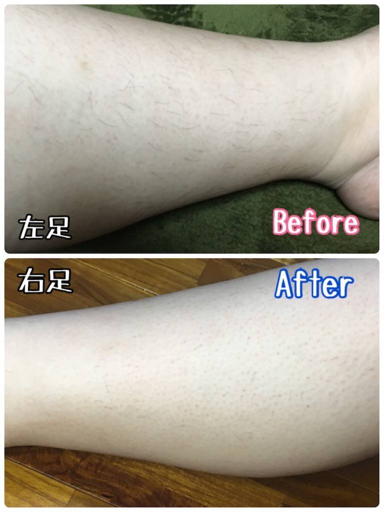 f:id:oki-gura:20190803225651j:image f:id:oki-gura:20190803225651j:image