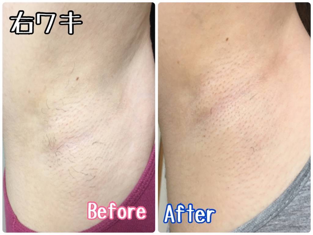 f:id:oki-gura:20190803225656j:image f:id:oki-gura:20190803225656j:image