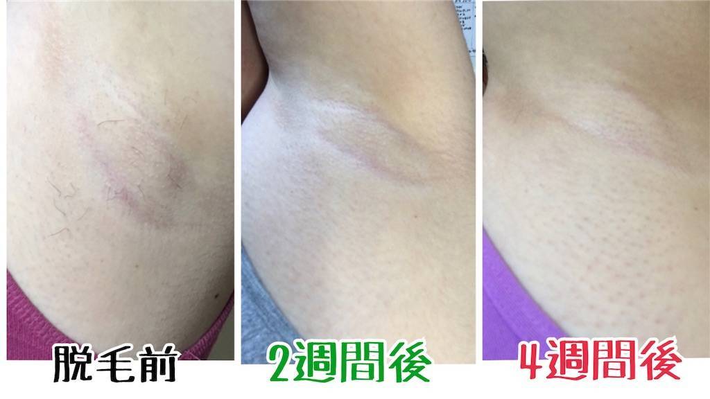 f:id:oki-gura:20190821140856j:plain f:id:oki-gura:20190821140856j:plain