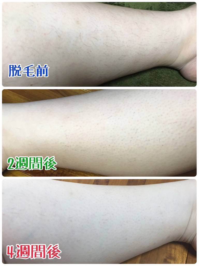 f:id:oki-gura:20190821140915j:image f:id:oki-gura:20190821140915j:image