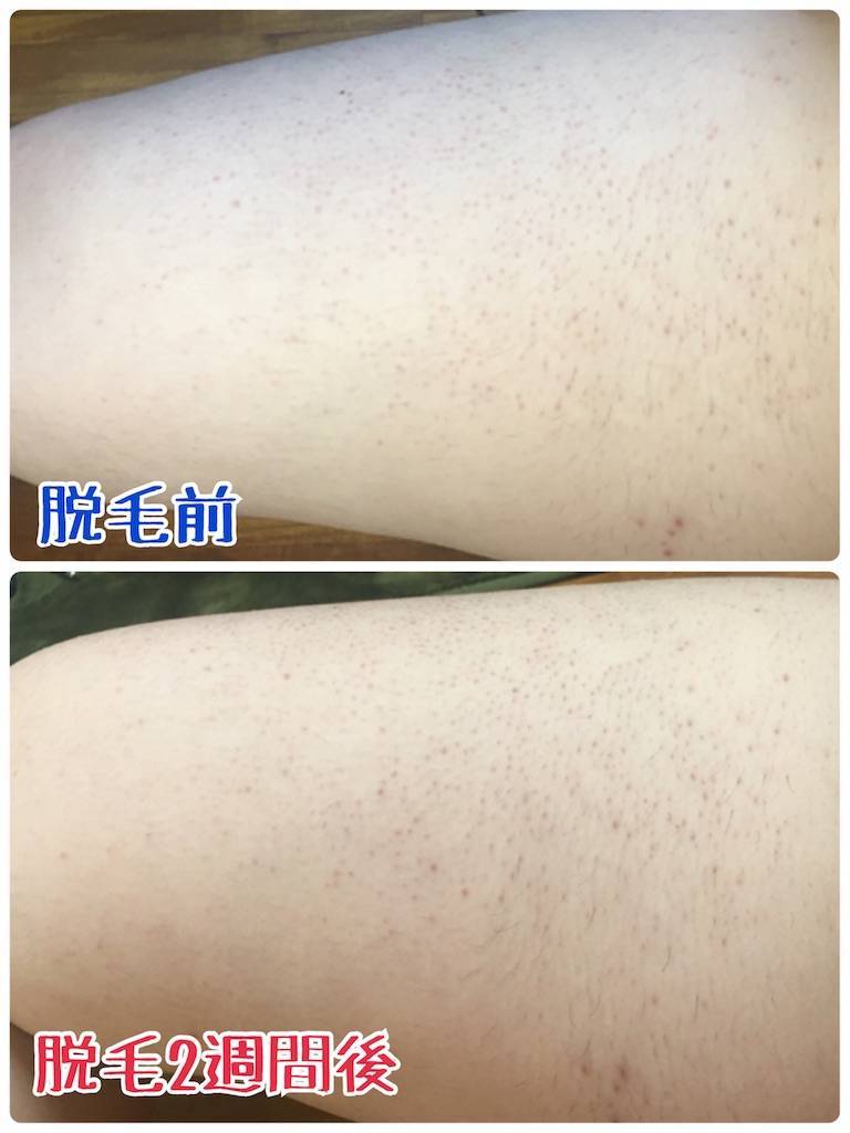 f:id:oki-gura:20190821140924j:image f:id:oki-gura:20190821140924j:image