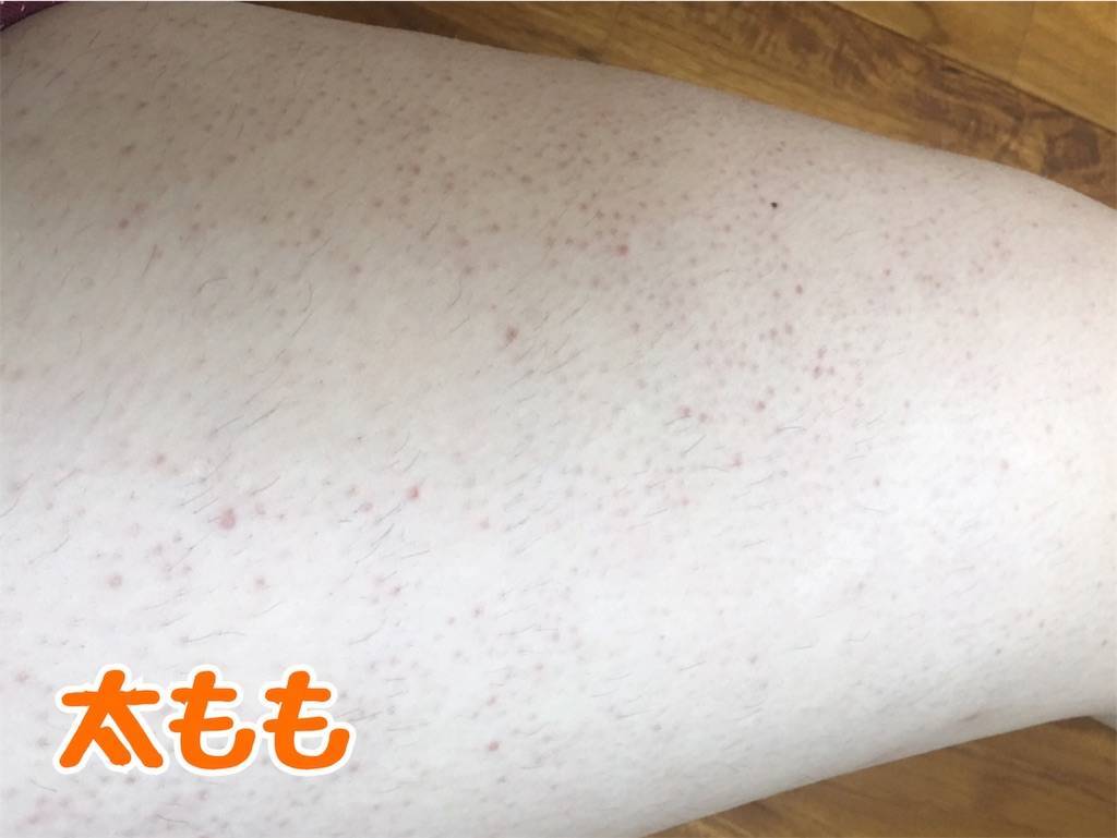 f:id:oki-gura:20190821155354j:image f:id:oki-gura:20190821155354j:image