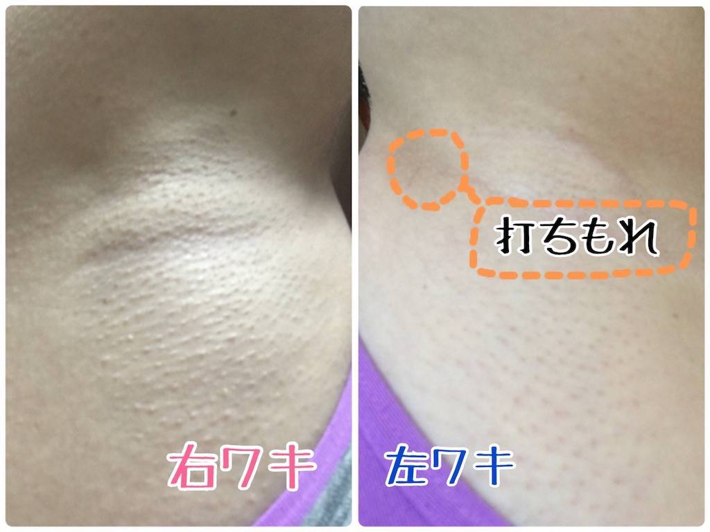 f:id:oki-gura:20190821164511j:image f:id:oki-gura:20190821164511j:image