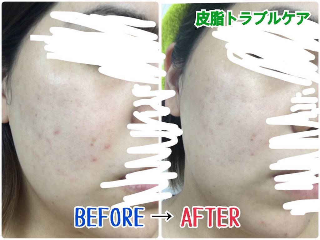f:id:oki-gura:20191020105439j:plain f:id:oki-gura:20191020105439j:plain