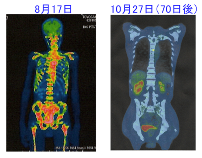 f:id:okinawayoshi:20211117143315p:plain