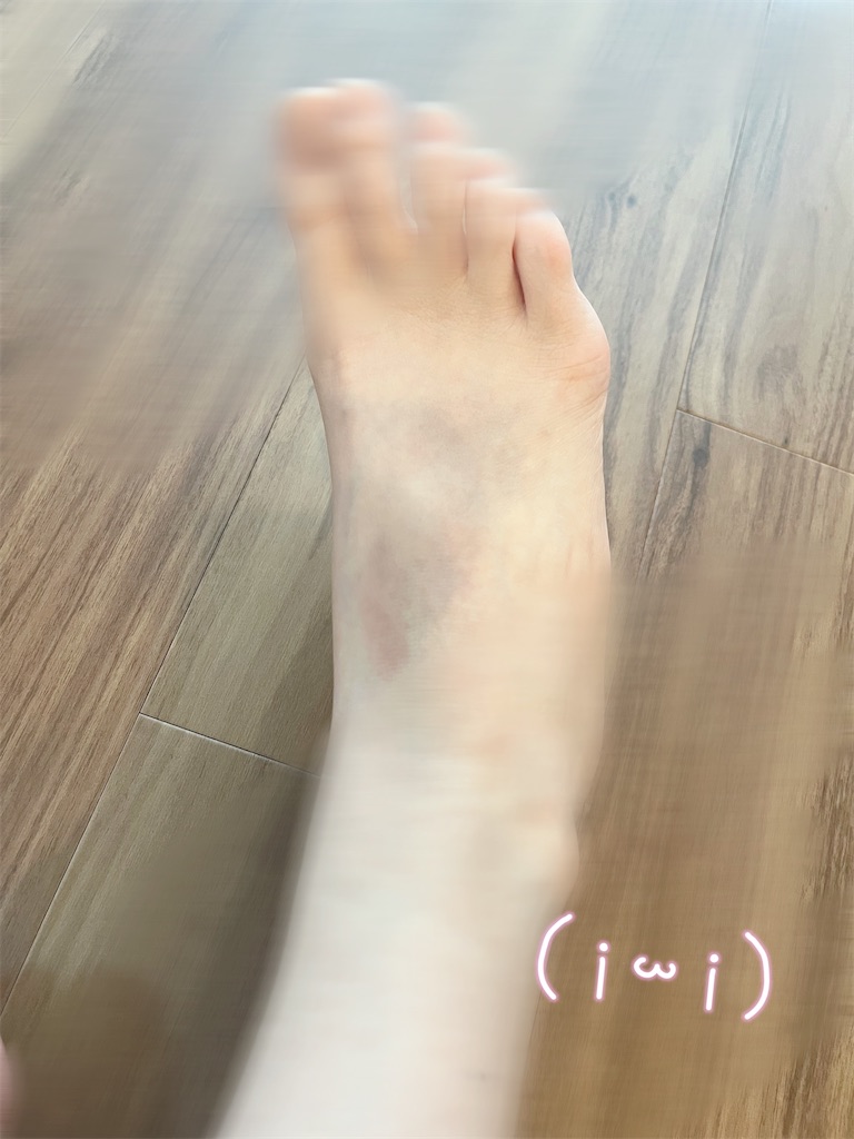 f:id:okirakunahaha:20260603113200j:image f:id:okirakunahaha:20260603113200j:image