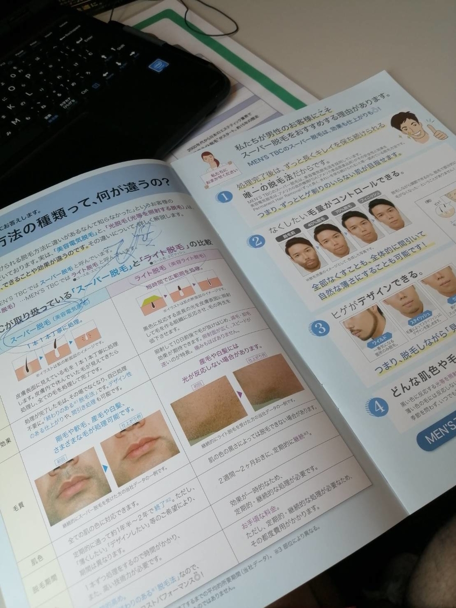 メンズTBCのヒゲ脱毛体験に行ってきました【口コミ】