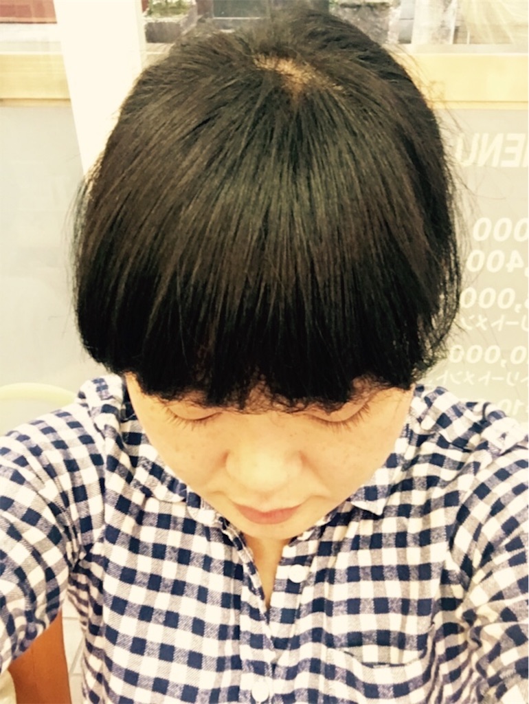 f:id:okomeyone:20161204152921j:image f:id:okomeyone:20161204152921j:image