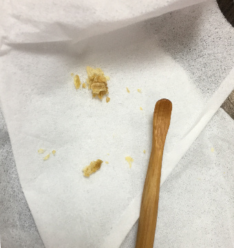 子供の耳の聞こえが悪い 大量の耳垢をとったら ゆるゆるスマイル