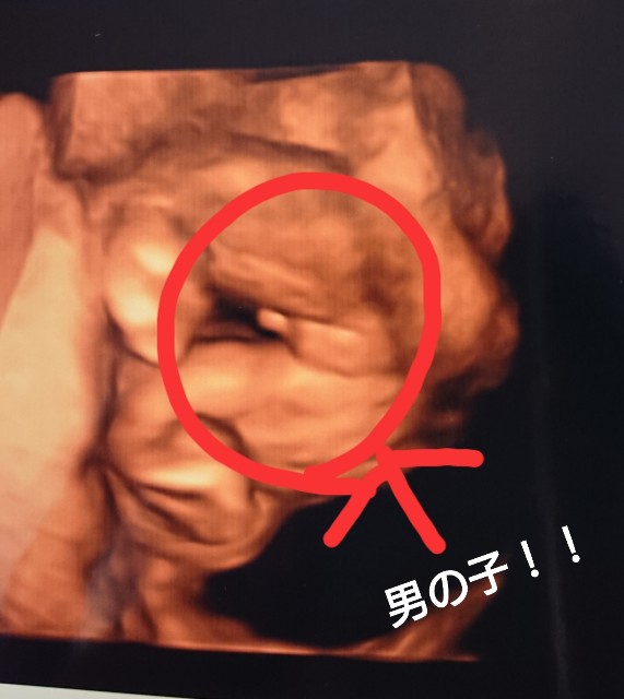 f:id:okorenaimama:20180831151932j:image f:id:okorenaimama:20180831151932j:image