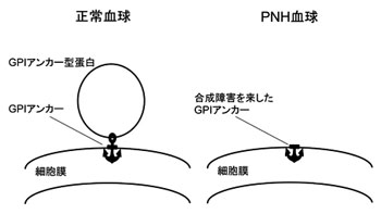 GPIアンカー