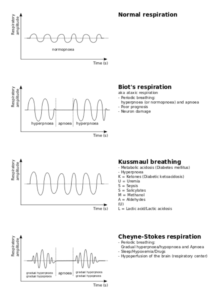 呼吸パターンのグラフ