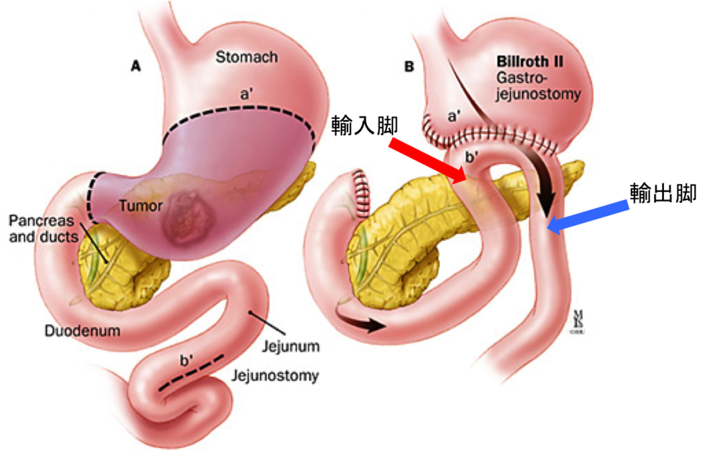 輸入脚と輸出脚
