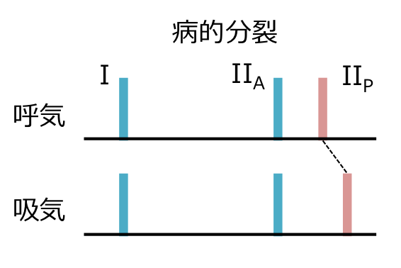 ２音の病的分裂