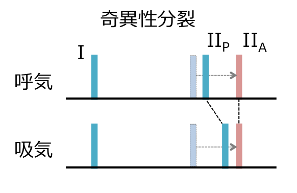 f:id:okotono:20170801162940p:plain