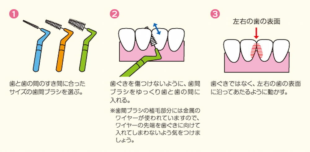 歯間ブラシ 使用方法