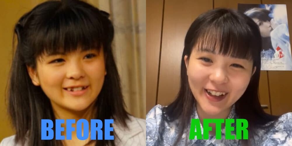 田村芽実 リサポン ビフォーアフター