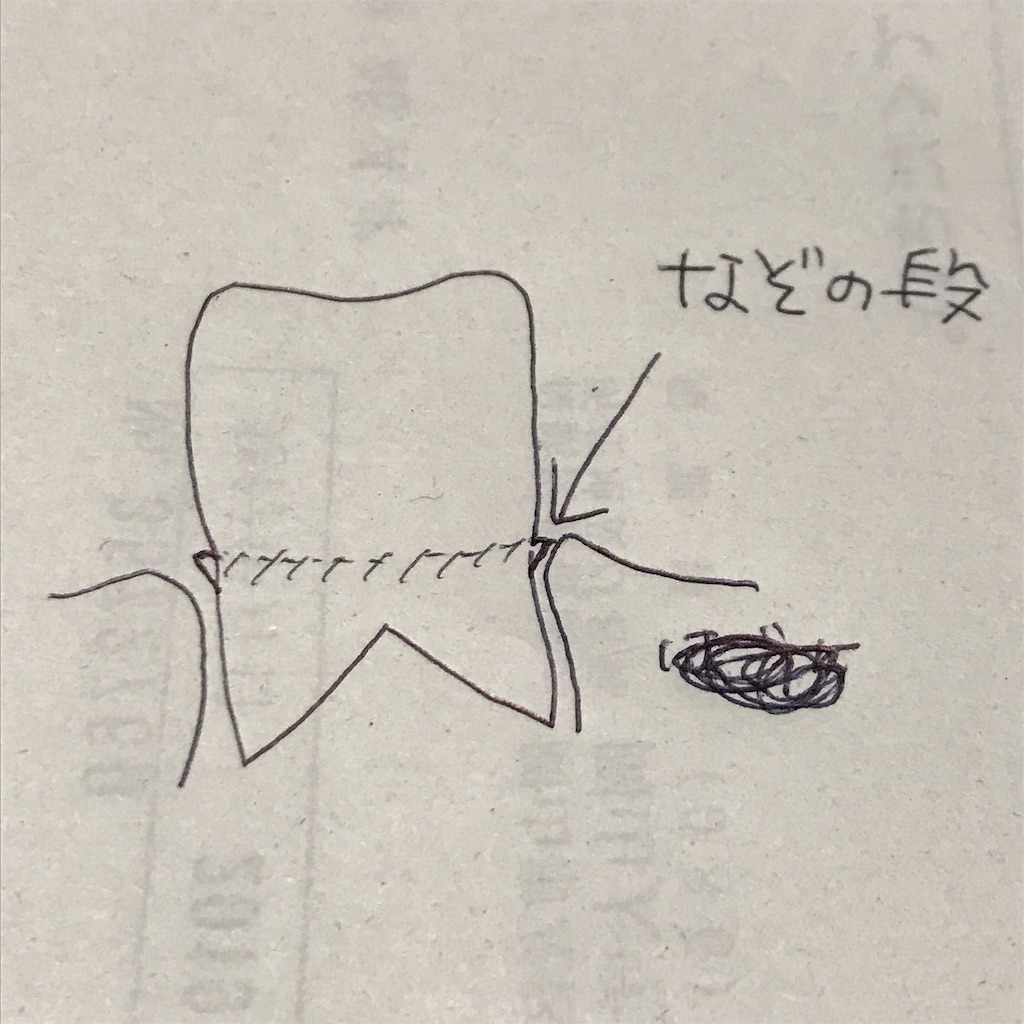 f:id:okudama-mo:20190819191147j:image