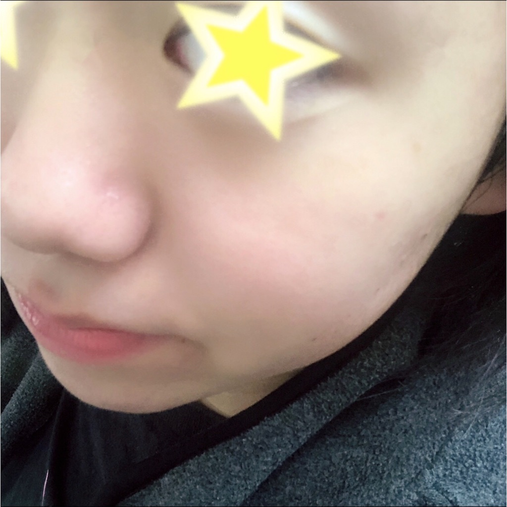 f:id:omayux:20181105233544j:image f:id:omayux:20181105233544j:image