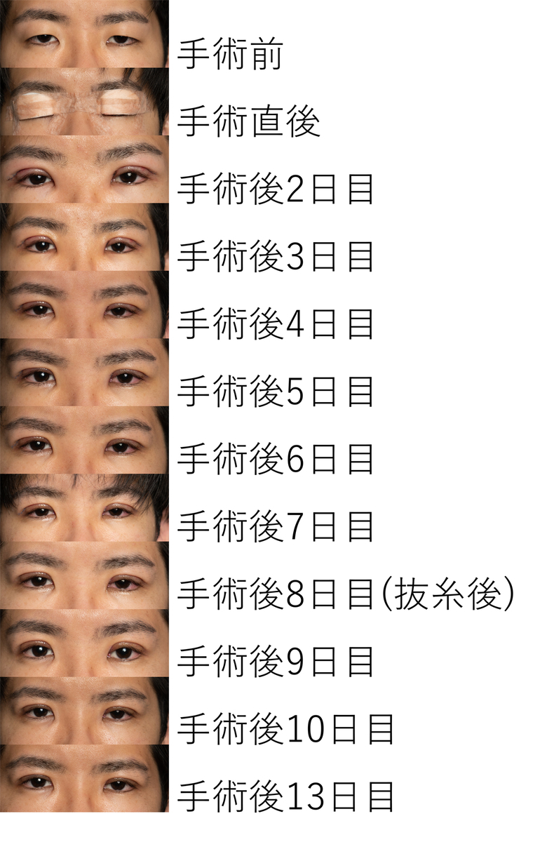 整形美人 とは テレビの人気 最新記事を集めました はてな 整形美人 とは テレビの人気 最新記事を集めました はてな