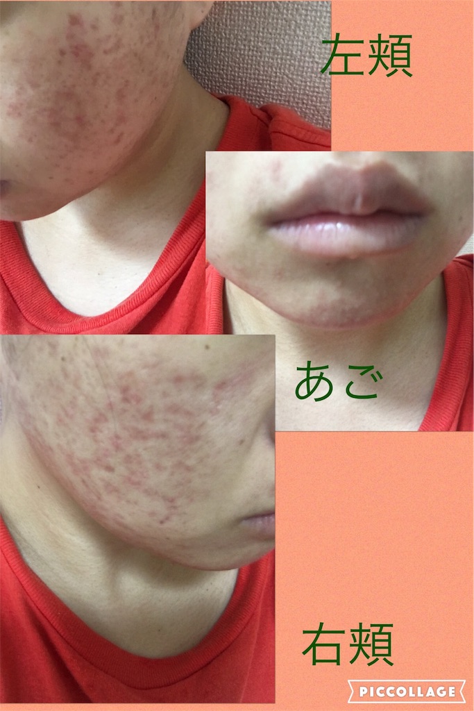 経過報告 再 1日目 カラフルに生きよう