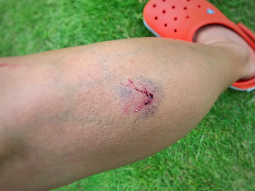 f:id:one00one:20170922181954j:plain