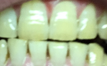 f:id:oneputtkun:20180108084253p:plain
